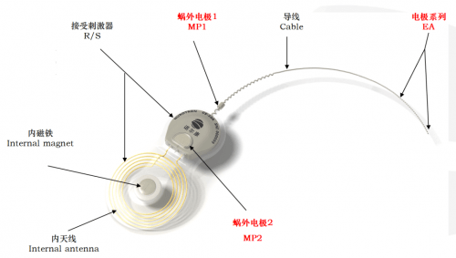 录音设备与新骨瓷的优点