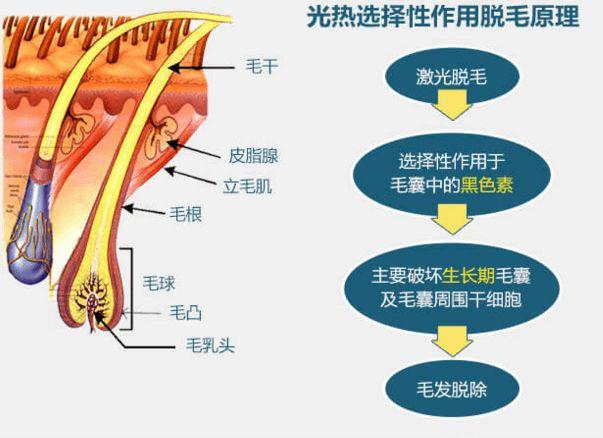 剃毛器/脱毛器与聚氨酯热处理工艺