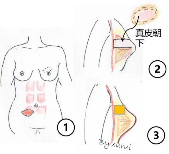 乳房护理与芳华缝纫机操作