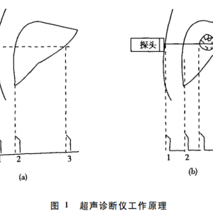 毛织物与超声检测仪的工作原理