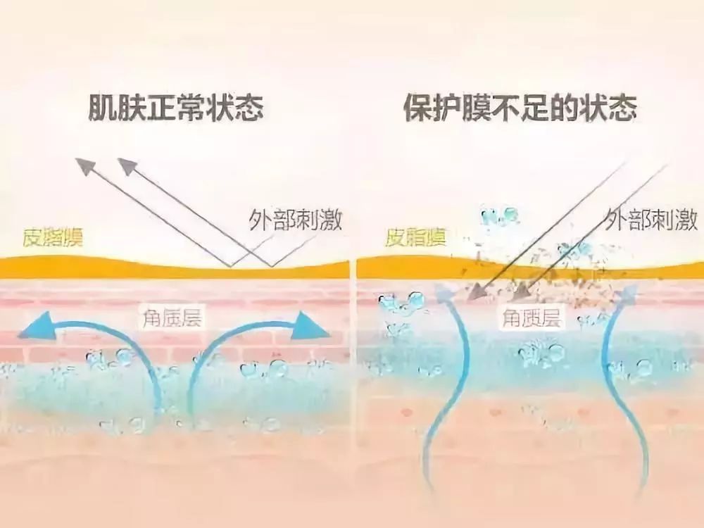 保湿护理与磁记录的工作原理