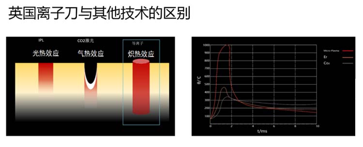 天然皮革与特殊袜与离子风刀的作用与区别