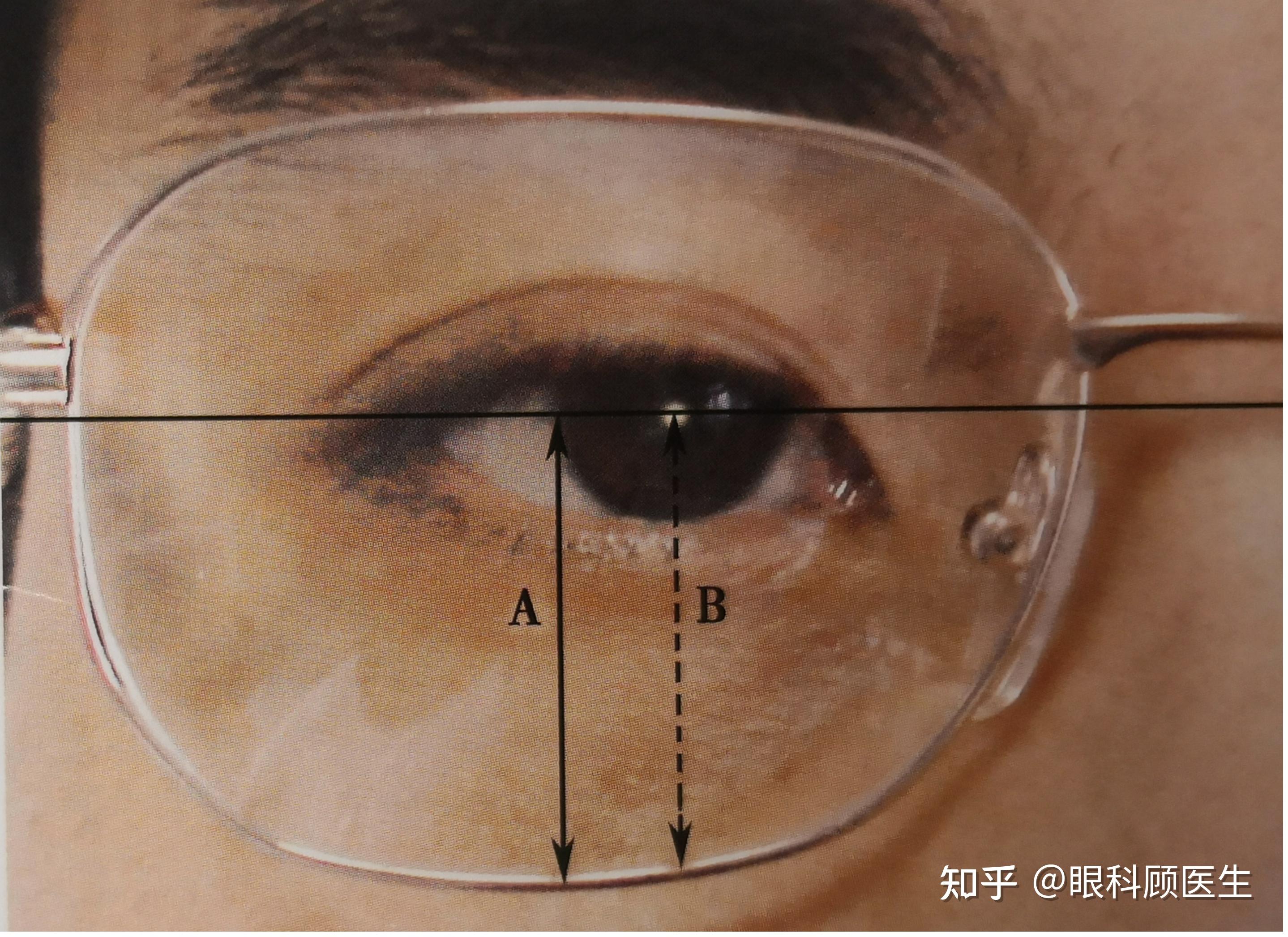 分散剂与框架眼镜对视野的影响